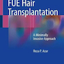 Fue Hair Transplantation : A Minimally Invasive Approach