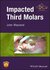 2018 Impacted Third Molars 1st Edition