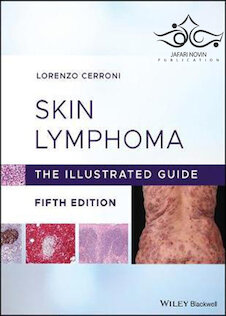 تخفیف Skin Lymphoma The Illustrated Guide 5th Edition 2020