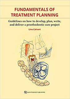 F undamentals of Treatment Planning : Guidelines on How to Develop, Plan, Write, and Deliver a Prosthodontic Care