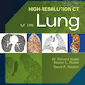 High-Resolution CT of the Lung Fifth Edition2014 سی تی ریه با وضوح بالا