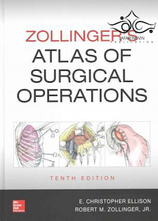 عکس Zollinger’s Atlas of Surgical Operations, 10th Edition2016 اطلس عملیات جراحی