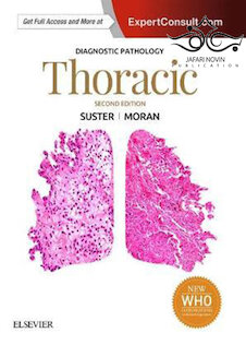 تخفیف Diagnostic Pathology: Thoracic, 2nd Edition2017 آسیب شناسی تشخیصی: قفسه سینه