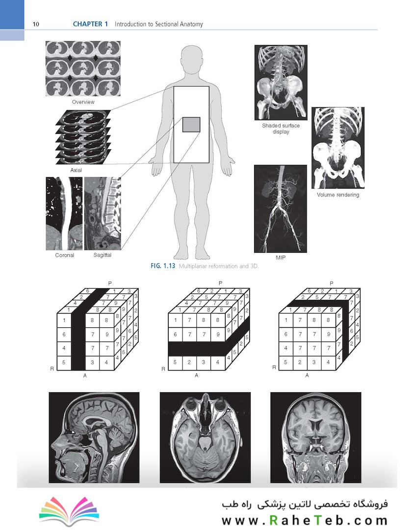 Sectional Anatomy for Imaging Professionals 4th Edition2018
