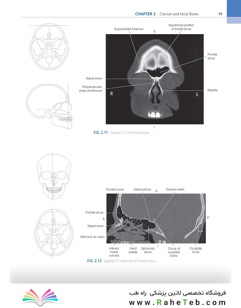 Sectional Anatomy for Imaging Professionals 4th Edition2018