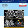 Neurosonology and Neuroimaging of Stroke, 2nd Edition2017 عصب شناسی و تصویربرداری عصبی از سکته مغزی