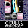 Ocular Pathology, 7th Edition2014 آسیب شناسی چشم