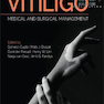 Vitiligo: Medical and Surgical Management 1st Edition2018 ویتیلیگو: مدیریت پزشکی و جراحی
