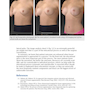 Breast Augmentation Video Atlas, 2nd Edition 2019