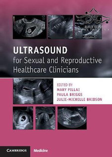 عکس Ultrasound in Reproductive Healthcare Practice2018 سونوگرافی در عمل بهداشت باروری