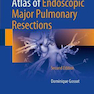 Atlas of Endoscopic Major Pulmonary Resections 2nd Edition2017 اطلس برداشت های عمده ریوی آندوسکوپی