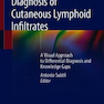 Diagnosis of Cutaneous Lymphoid Infiltrates 1st Edition2019 تشخیص نفوذهای لنفاوی جلدی