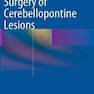 Surgery of Cerebellopontine Lesions2013 جراحی ضایعات