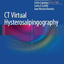 CT Virtual Hysterosalpingography2014 CT هیستروسالپنگوگرافی مجازی