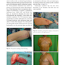 Plastic and Cosmetic Surgery of the Male Breast2021 جراحی پلاستیک و زیبایی پستان نر