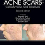 Acne Scars: Classification and Treatment, 2nd Edition