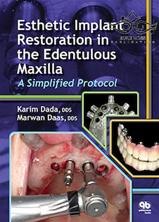 Esthetic Implant Restoration in the Edentulous Maxilla2014 ترمیم ایمپلنت زیبایی در فک بالا