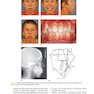 Orthodontics in the Vertical Dimension