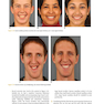 Orthodontics in the Vertical Dimension