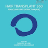 Hair Transplant 360: Follicular Unit Extraction (FUE)2019