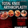 Total Knee Arthroplasty, 2nd Edition2014 آرتروپلاستی کامل زانو