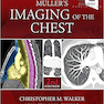 Muller’s Imaging of the Chest, 2nd Edition2018