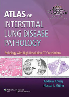 عکس Atlas of Interstitial Lung Disease Pathology 2014