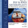 Tips and Tricks in Hip and Knee Arthroplasty2014 نکات و نکاتی در آرتروپلاستی مفصل ران و زانو