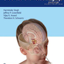 Pediatric Endoscopic Endonasal Skull Base Surgery2020 جراحی پایه جمجمه اندونازال کودکان
