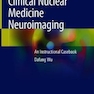 درمان پزشکی هسته ای Nuclear Medicine Therapy