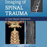 Clinical Imaging of Spinal Trauma 1st Edition2018تصویربرداری بالینی ترومای نخاعی ویرایش اول
