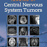 Imaging of Central Nervous System Tumors2021تصویربرداری از تومورهای سیستم عصبی مرکزی
