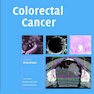 Colorectal Cancer2008سرطان روده بزرگ