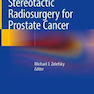 Stereotactic Radiosurgery for Prostate Cancer2018رادیو جراحی استریوتاکتیک برای سرطان پروستات