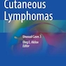 Cutaneous Lymphomas : Unusual Cases 3لنفوم های جلدی: موارد غیر معمول 3