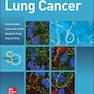 Lung Cancer: Standards of Careسرطان ریه: استانداردهای مراقبت