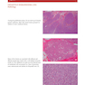 Color Atlas of Vascular Tumors and Vascular Malformations 1st Edicion 2007