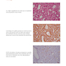 Color Atlas of Vascular Tumors and Vascular Malformations 1st Edicion 2007