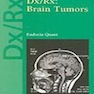Dx/Rx : Brain Tumors