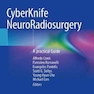 CyberKnife NeuroRadiosurgery : A practical Guide