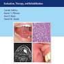 Oral Cancer : Evaluation, Therapy, and Rehabilitationسرطان دهان: ارزیابی ، درمان و توانبخشی