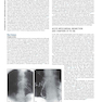 Braunwald’s Heart Disease, 2 Vol Set: A Textbook of Cardiovascular Medicine2022