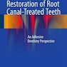 Restoration of Root Canal-Treated Teeth : An Adhesive Dentistry Perspective