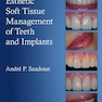 Esthetic Soft Tissue Management of Teeth and Implants