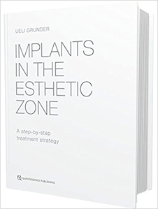 تخفیف Implants in the Esthetic Zone : A Step-by-Step Treatment Strategy