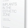 Implants in the Esthetic Zone : A Step-by-Step Treatment Strategy