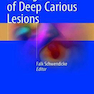 Management of Deep Carious Lesions 2018