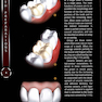 Tooth Preparations 1st Edicion 2017