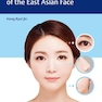 Aesthetic Plastic Surgery of the East Asian Face