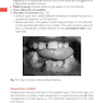 Oral and Maxillofacial Surgery (Oxford Specialist Handbooks in Surgery) 3rd Edicion 2020